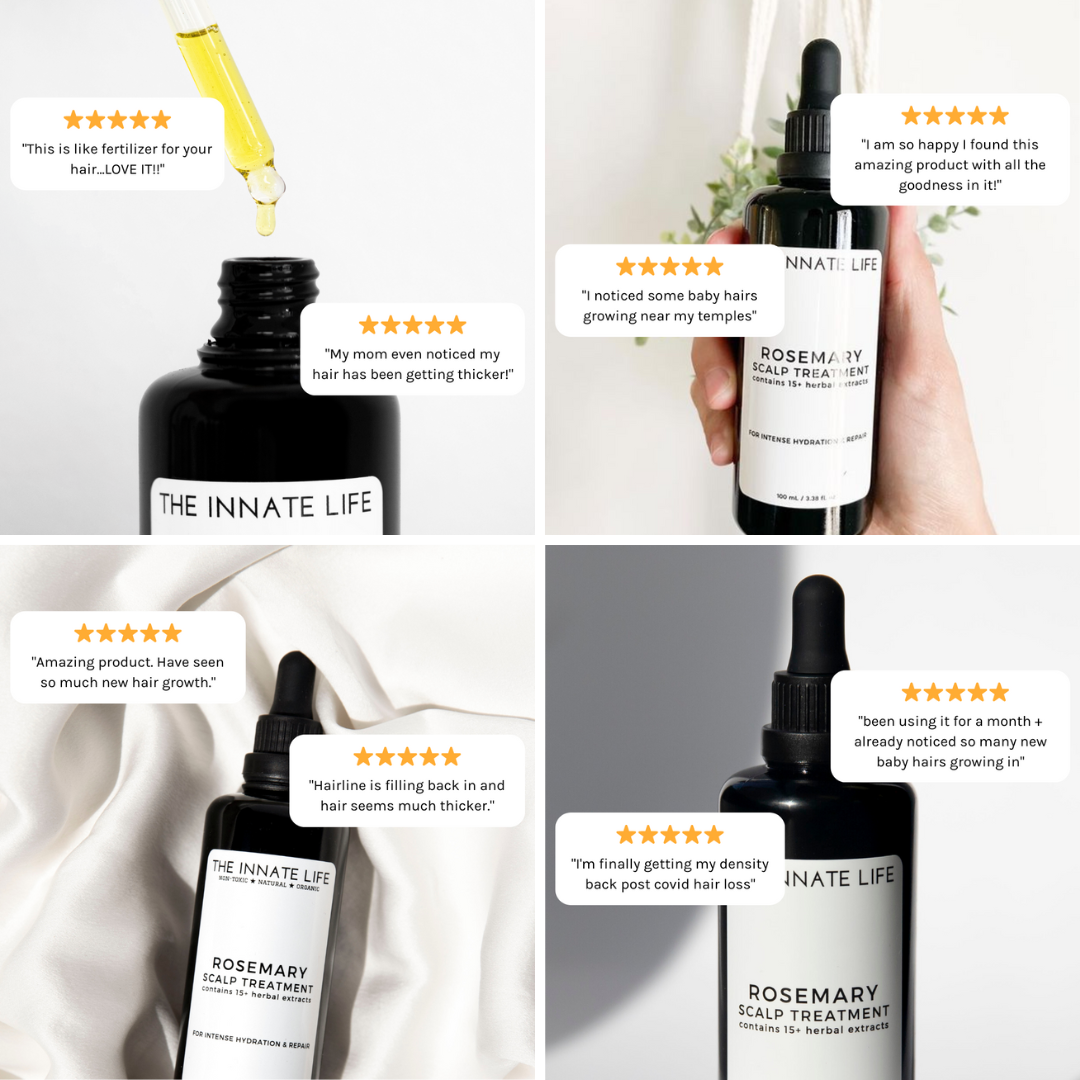 ROSEMARY SCALP TREATMENT – The Innate Life